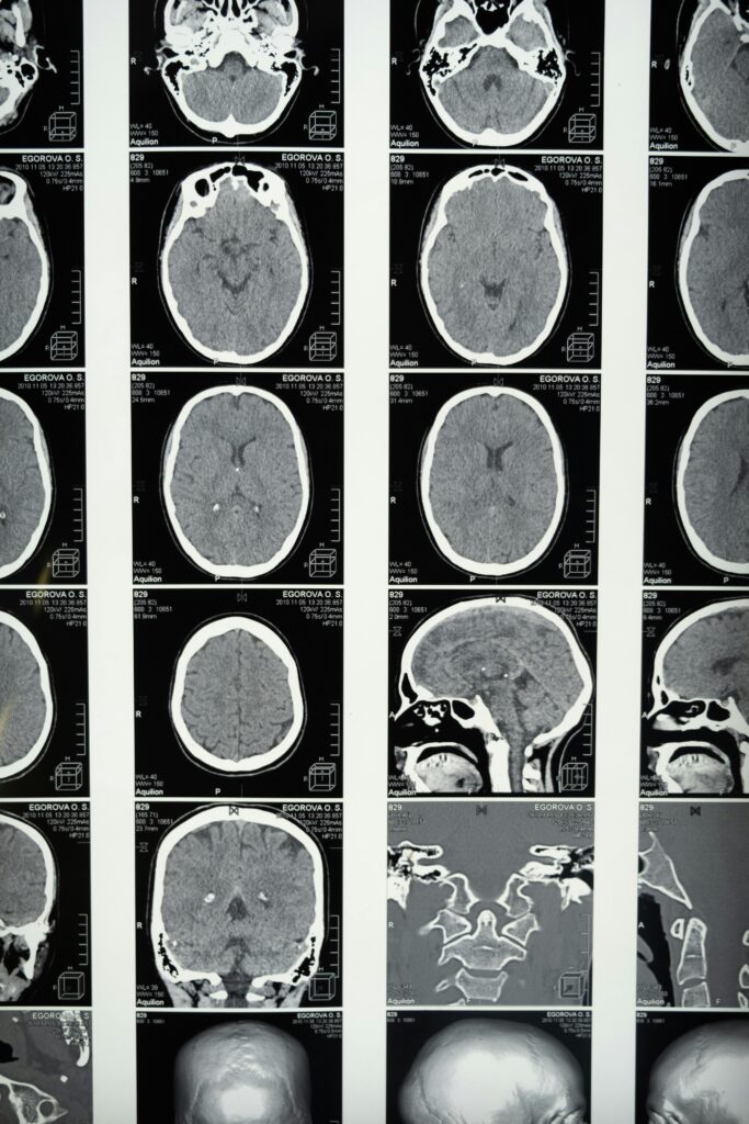 Comprehensive set of brain MRI scans highlighting cranial anatomy for medical use.
